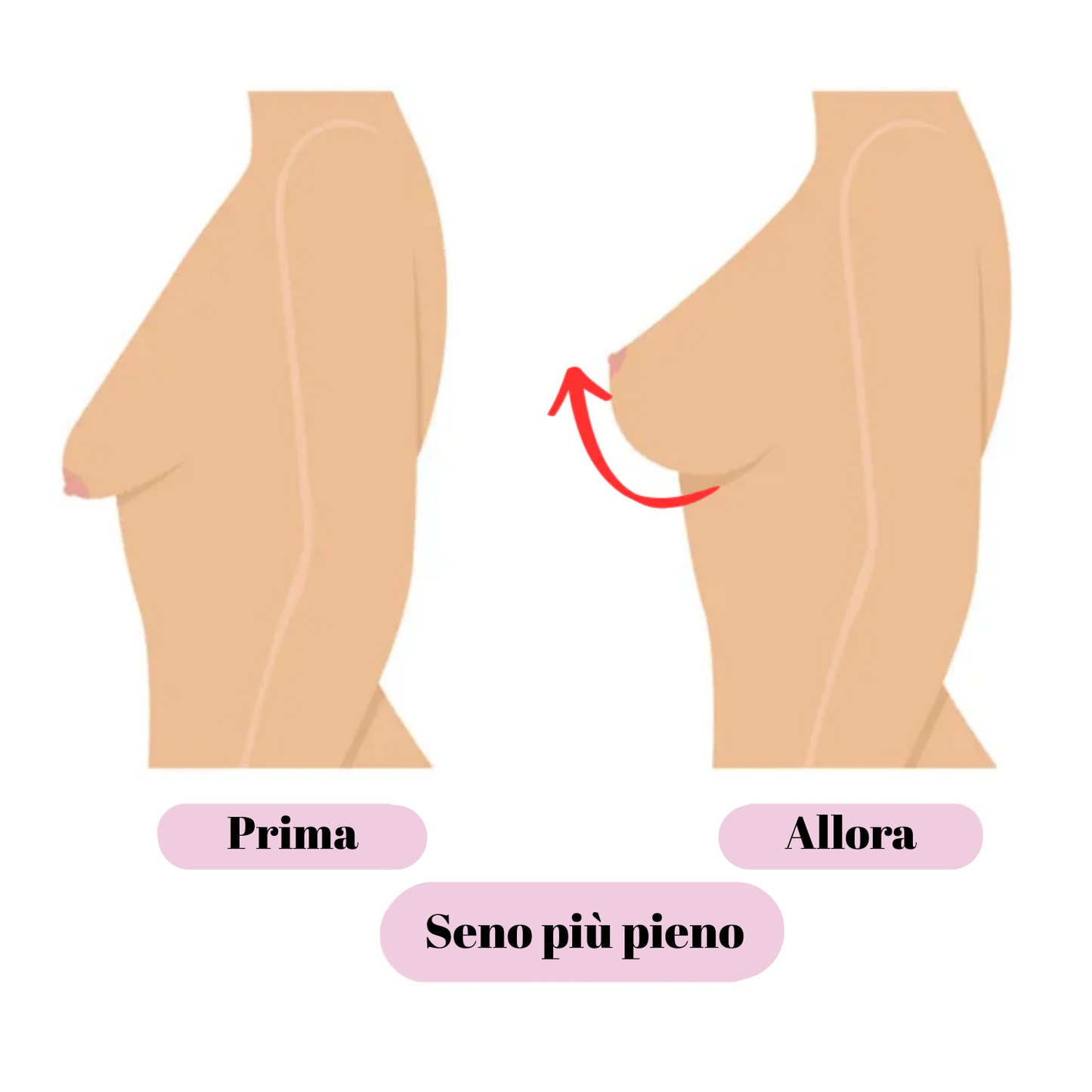 Collagene per l'aumento del seno